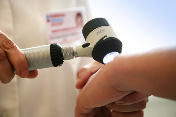 Alarmující výsledky přinesl Den prevence melanomu na Poliklinice AGEL v Nymburce